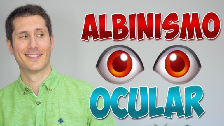 Descubre la definición y características del albinismo ocular: Todo lo que necesitas saber