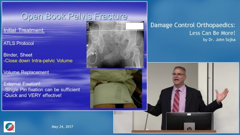 Guía definitiva en PDF sobre control de daños en ortopedia: todo lo que necesitas saber