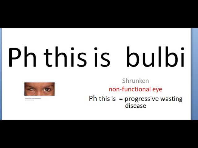 Descubre cómo tratar eficazmente el phitis bulbi y recuperar una visión saludable